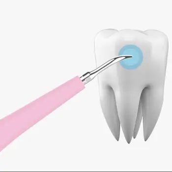 Zuby Zdravie Hygiena Prenosné Elektrické Sonická Zubná Scaler Zubnému Kameňu Odstraňovač Zubného Škvrny Zubného Kameňa Nástroj Zubár Bielenie Obrázok