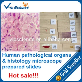 Ľudské patologické orgánov a histology pripravené listov,patologické orgánov listov,ľudských orgánov listov Obrázok