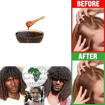 Prirodzene Vypestujte Vlasy Popôrodné Ošetrenie Vlasov Pomocou Južnej Afriky Tribal Bylinný Šampón Stop Vlasy Jeseň Keratínu Doplnok Obrázok