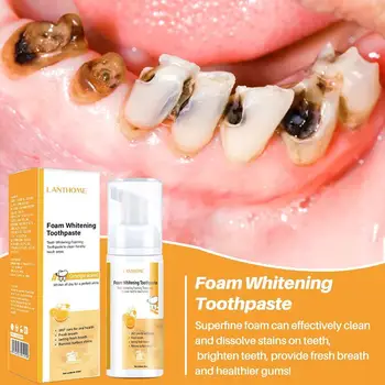 50ML Profesionálne Čistenie Zubov foaming zubná pasta Whitening Mousse Škvŕn, Odstránenie Zubov Booster Pre Ženy, Mužov G3B8 Obrázok