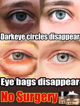 Očný Krém Odstrániť Očné Tašky Tmavé Kruhy Pod Opuchy Pod Očami Tmavé Kruhy Pod Očami Kruhy Očné Krémy Na Očné Vrásky Obrázok